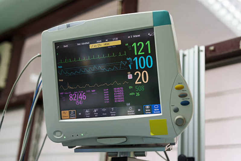 Aluguel de Monitor Cardíaco Preço Sassi - Aluguel de Monitor Cardíaco