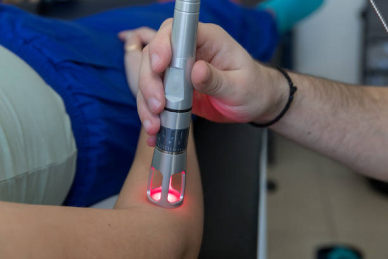 Laserterapia para Tratamento de Fungos Valores Área Rural de Passo Fundo - Laserterapia na Podologia