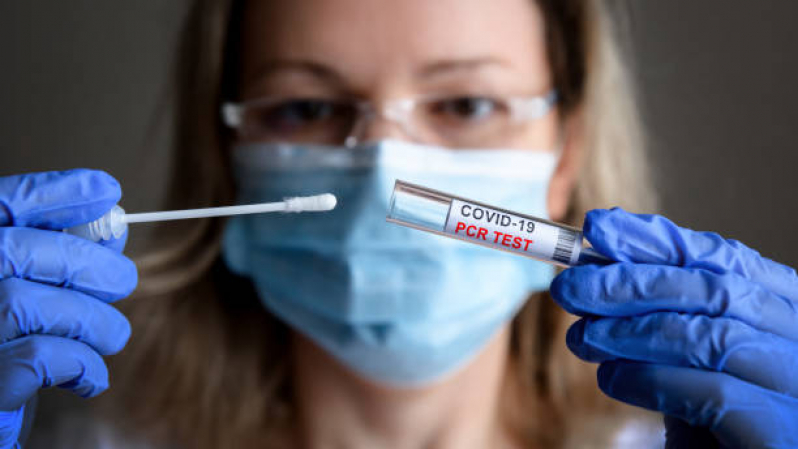 Teste de Covid-19 Valores Vila Aldo Arioli Cohab - Teste para Influenza