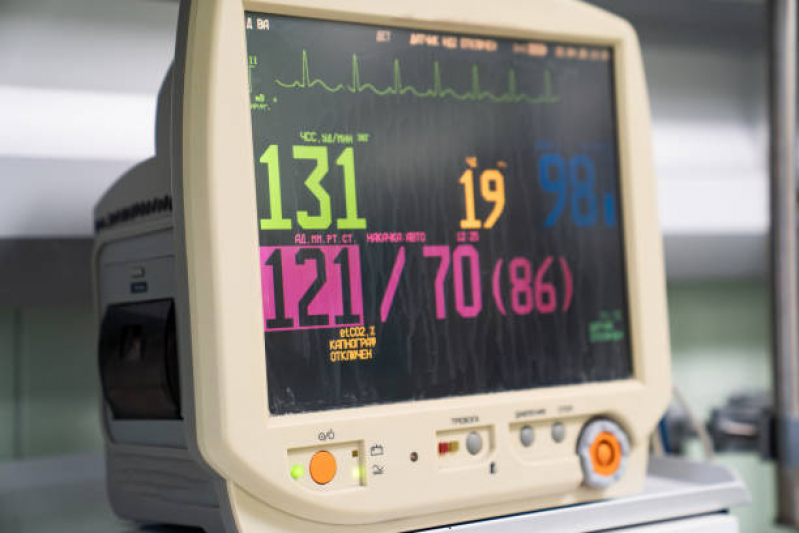Valor de Aluguel de Monitor Cardíaco Centro - Aluguel de Bomba de Infusão